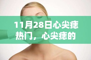 11月28日心尖痣热门，心尖痣的温馨日常，十一月二十八日的特别记忆