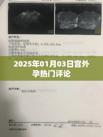 『2025年宫外孕最新热议评论』