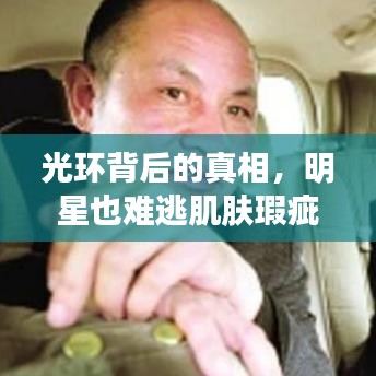 光环背后的真相，明星也难逃肌肤瑕疵之斑