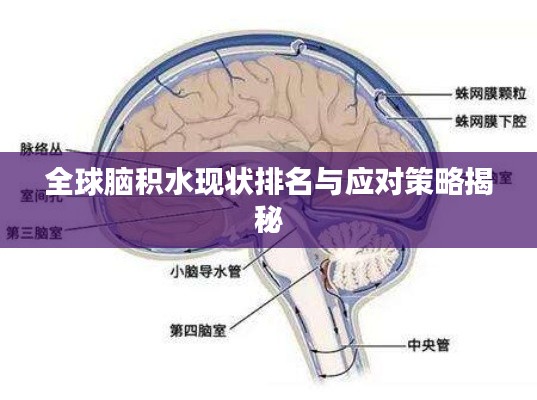 全球脑积水现状排名与应对策略揭秘