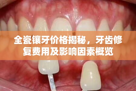 全瓷镶牙价格揭秘，牙齿修复费用及影响因素概览